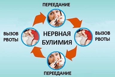 Лечение булимии в Каргополе